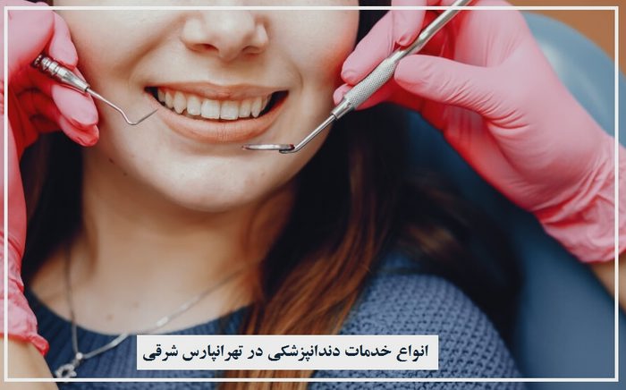 انواع خدمات دندانپزشکی در تهرانپارس شرقی