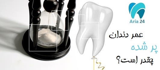 عمر دندان پر شده چقدر است؟