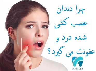 چرا دندان عصب کشی شده درد و عفونت می گیرد؟