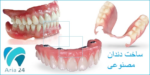 ساخت دندان مصنوعی غرب تهران